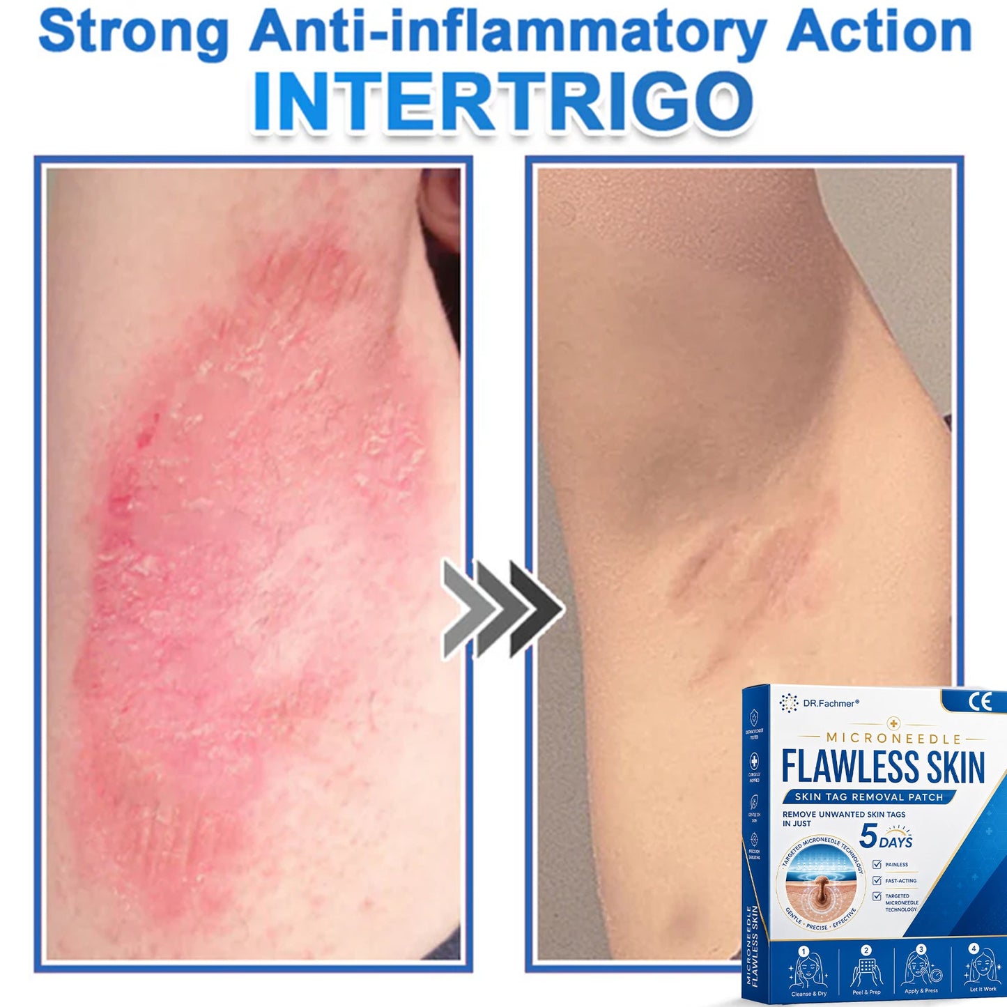 ✅ DR.Fachmer® 2-in-1 Microneedle & Hydrocolloid Patch 🌿| Raised Moles,Acne,  Flat Warts & Skin Tags Remover | Improves Wrinkles, Scars & Blemishes | Invisible Pimple Patches for Face & Body