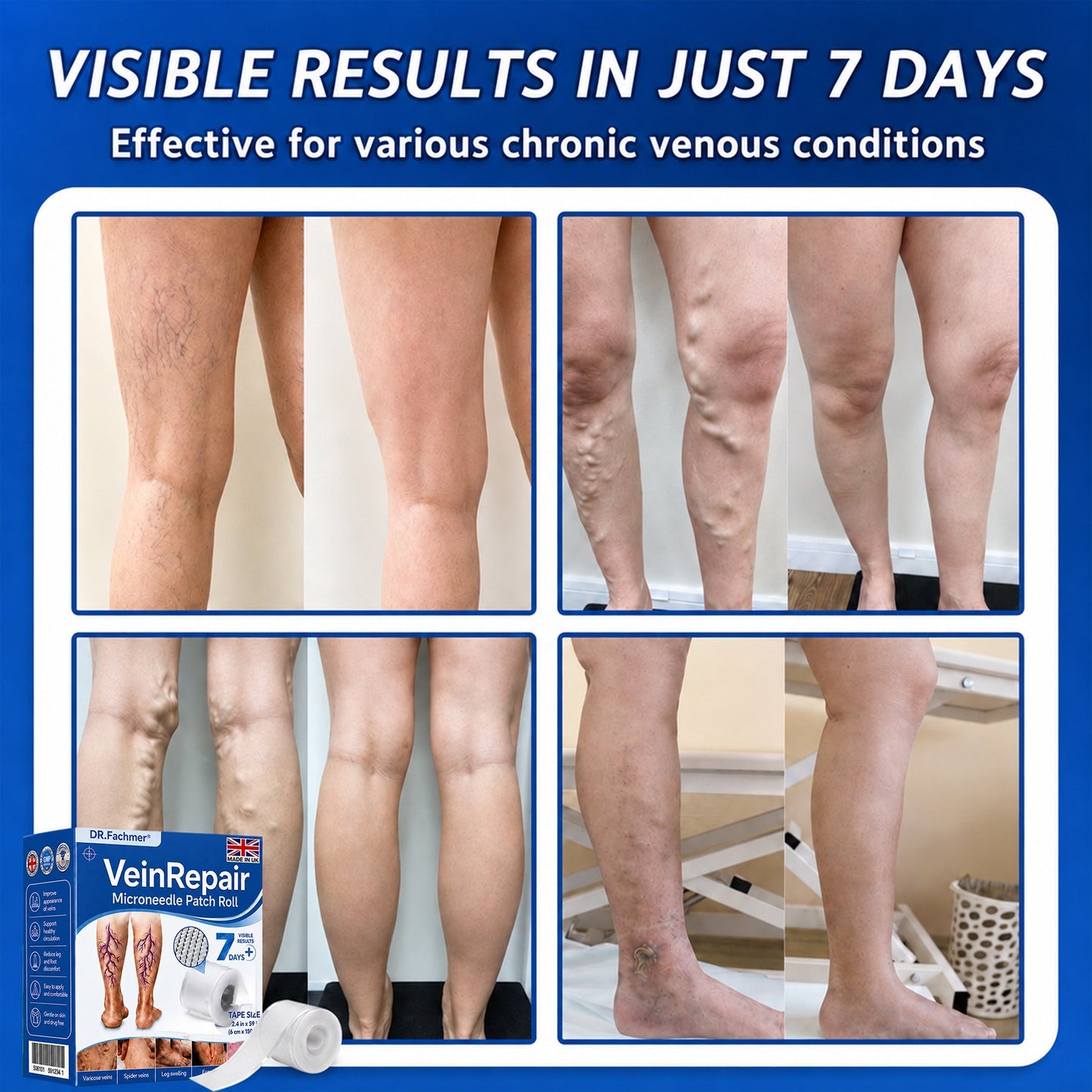 🦵DR.Fachmer® Vein Ease Microneedle Care Patch(For Spider Veins, Varicose Veins, Swelling & Leg Fatigue) - Last Day Promotion 50% OFF