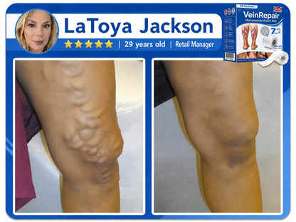 🦵DR.Fachmer® Vein Ease Microneedle Care Patch(For Spider Veins, Varicose Veins, Swelling & Leg Fatigue) - Last Day Promotion 50% OFF
