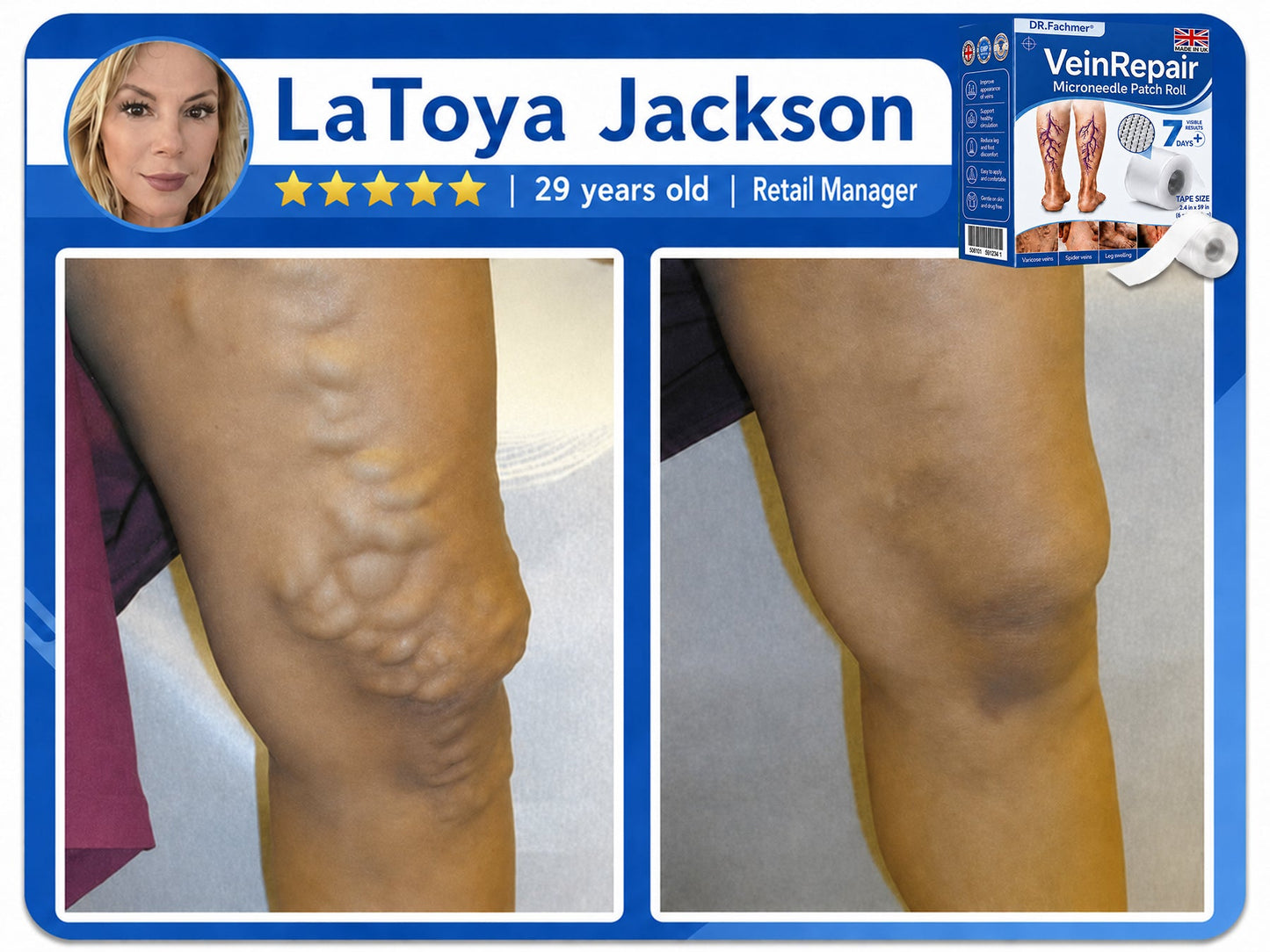 🩹DR.Fachmer® Vein Ease Microneedle Care Patch(For Spider Veins, Varicose Veins, Swelling & Leg Fatigue) - Last Day Promotion 50% OFF