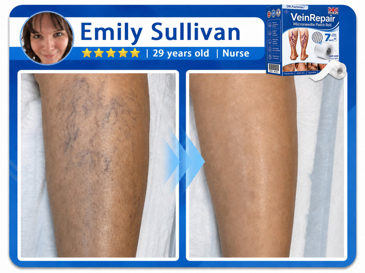 🦵DR.Fachmer® Vein Ease Microneedle Care Patch(For Spider Veins, Varicose Veins, Swelling & Leg Fatigue) - Last Day Promotion 50% OFF