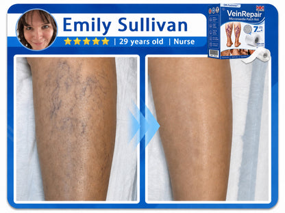 🌿DR.Fachmer® Vein Ease Microneedle Care Patch(For Spider Veins, Varicose Veins, Swelling & Leg Fatigue) - Last Day Promotion 50% OFF