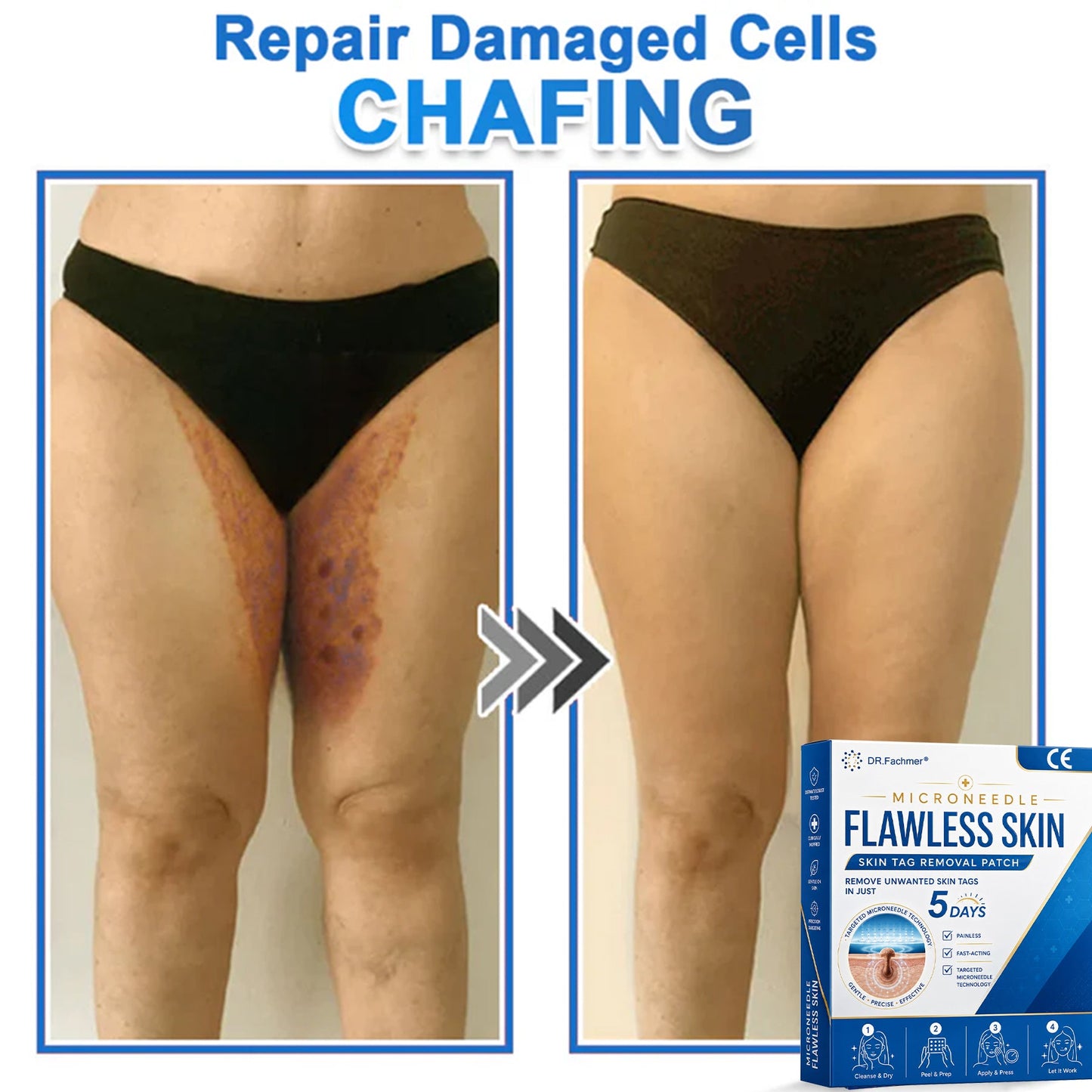✅ DR.Fachmer® 2-in-1 Microneedle & Hydrocolloid Patch 🌿| Raised Moles,Acne,  Flat Warts & Skin Tags Remover | Improves Wrinkles, Scars & Blemishes | Invisible Pimple Patches for Face & Body