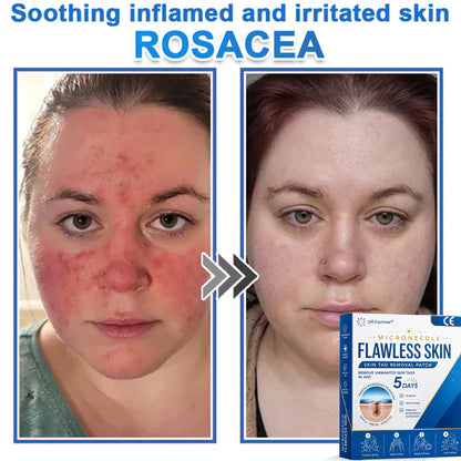 ✅ DR.Fachmer® 2-in-1 Microneedle & Hydrocolloid Patch 🌿| Raised Moles,Acne,  Flat Warts & Skin Tags Remover | Improves Wrinkles, Scars & Blemishes | Invisible Pimple Patches for Face & Body